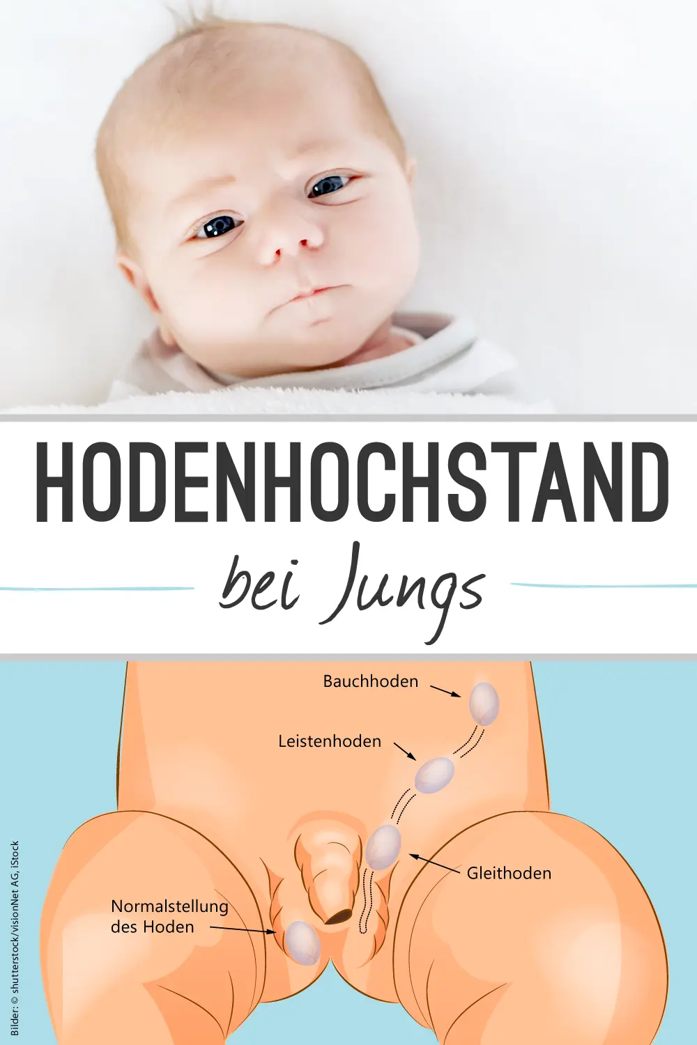 hoden bei babys - Wie Ertaste ich die Hoden Baby