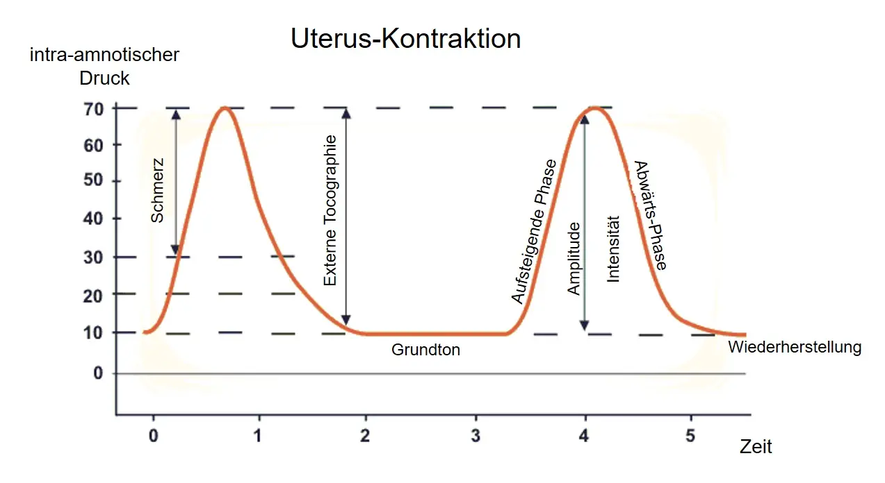 kontraktion geburt - Wie fühlen sich Gebärmutterkontraktionen an