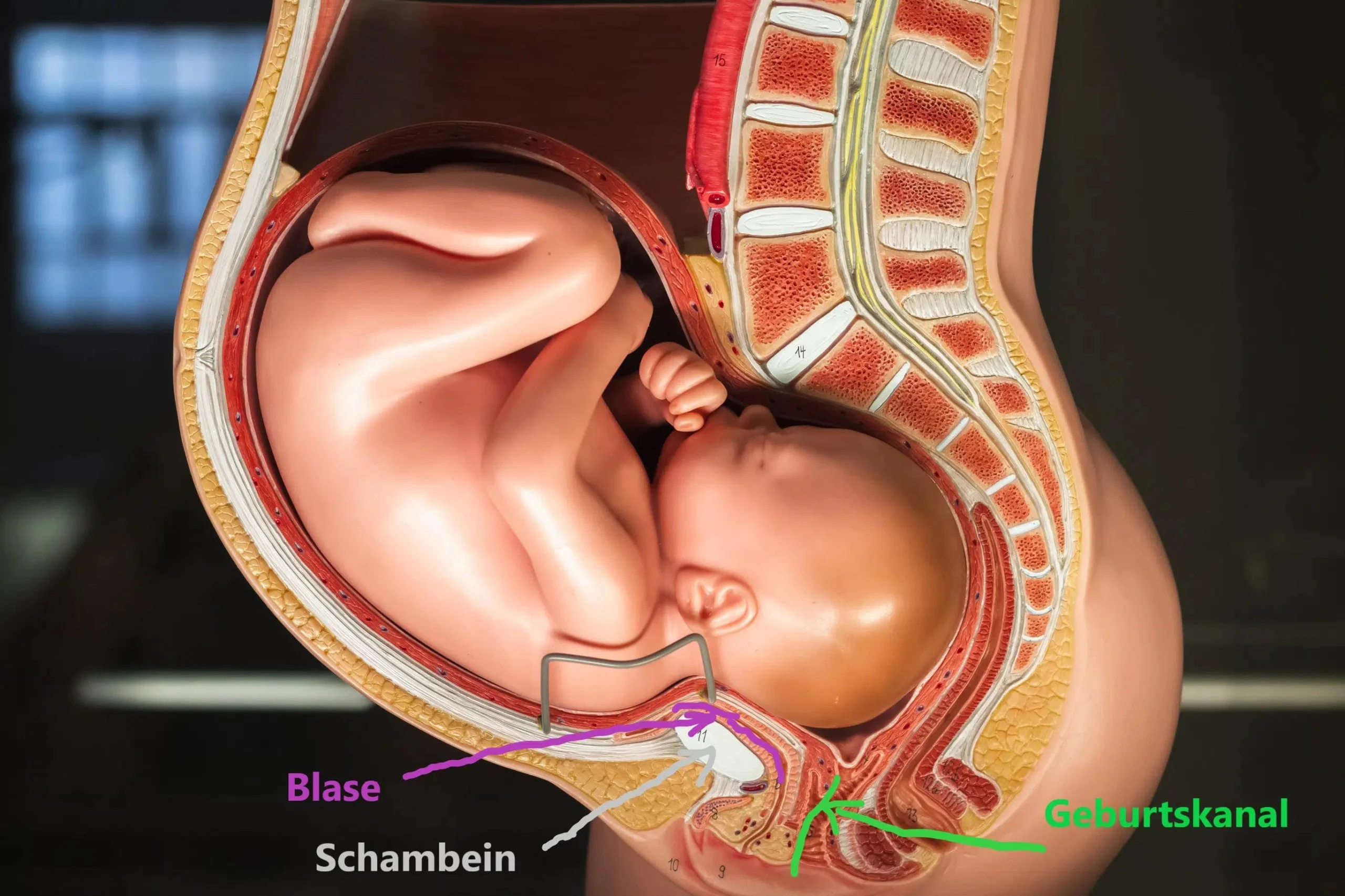 schambein geburt - Wie fühlen sich Schambeinschmerzen an