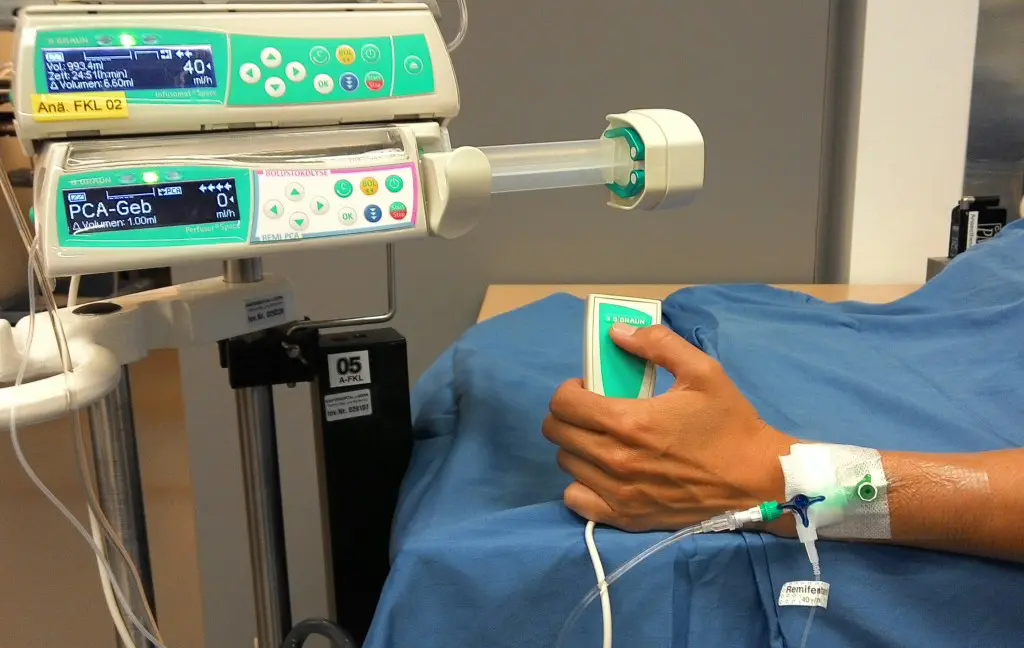 pca pumpe geburt - Wie funktioniert eine PCA Pumpe