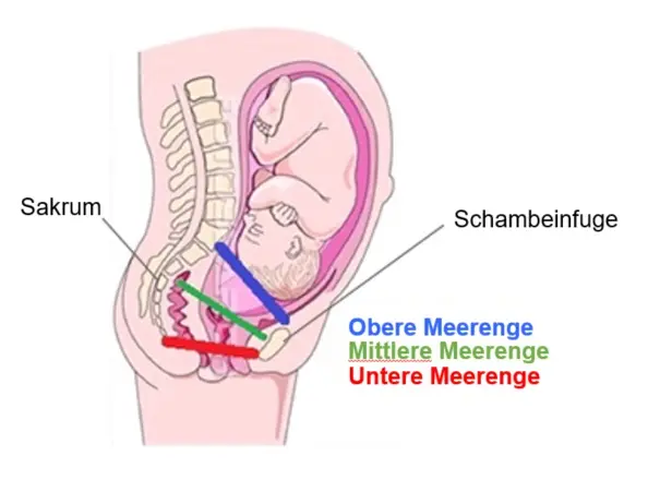 schambeinfuge geburt - Wie heilt man Schambeinschmerzen nach der Entbindung