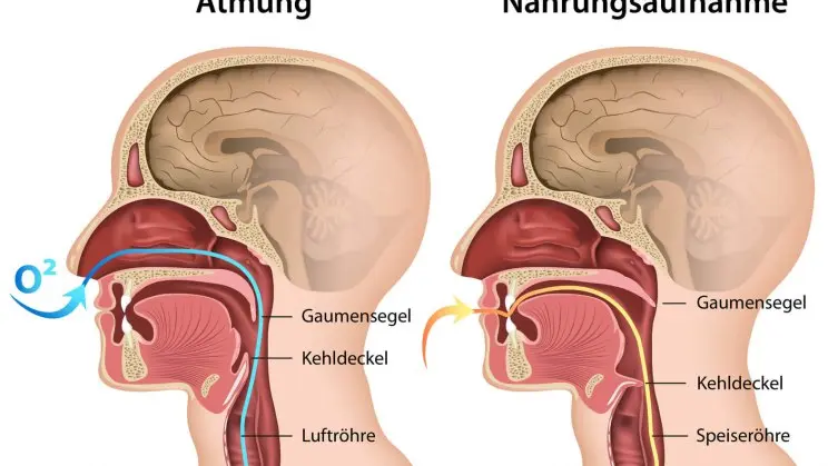 speiseröhre luftröhre klappe - Wie heißt die Klappe zwischen Luft und Speiseröhre