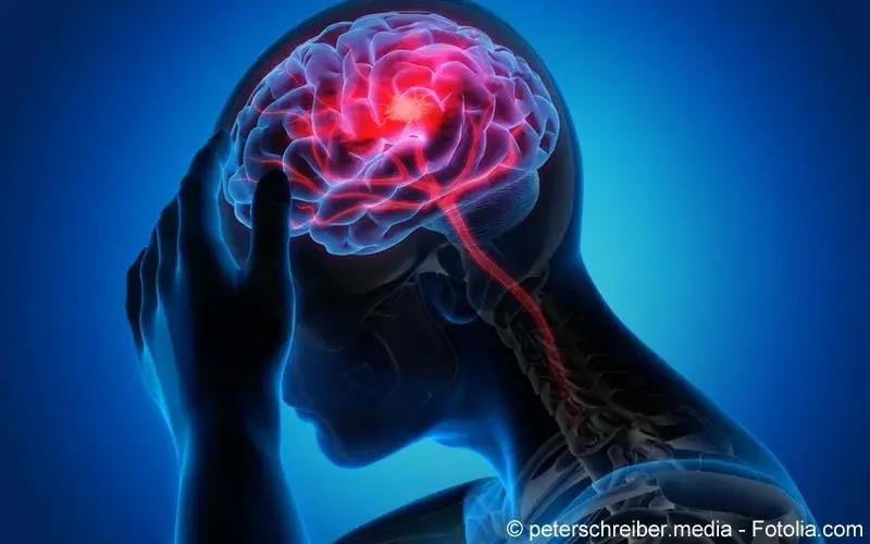 Hirnblutung durch Pressen bei Geburt: Ursachen, Symptome und Behandlung - Wie hoch ist die Chance bei einer Hirnblutung zu überleben hirnblutung durch pressen bei geburt - Wie hoch ist die Chance bei einer Hirnblutung zu überleben