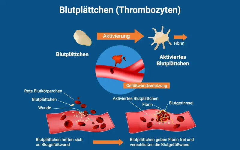 thrombozyten normalwert - Wie hoch sind die Thrombozyten bei einem gesunden Menschen