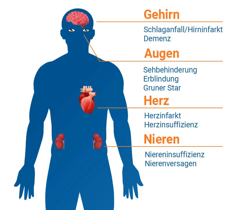 woran erkenne ich bluthochdruck - Wie kann ich herausfinden ob ich Bluthochdruck habe