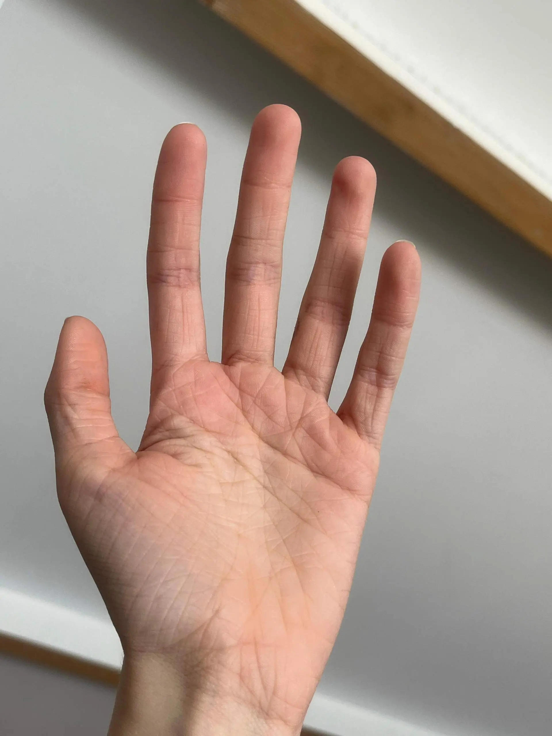 Faltige Hände nach der Geburt: Ursachen, Behandlung und Vorbeugung - Wie kann ich meine Hände verjüngen faltige hände seit geburt - Wie kann ich meine Hände verjüngen