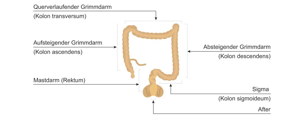 ileus ursachen - Wie kommt es zu einem Ileus