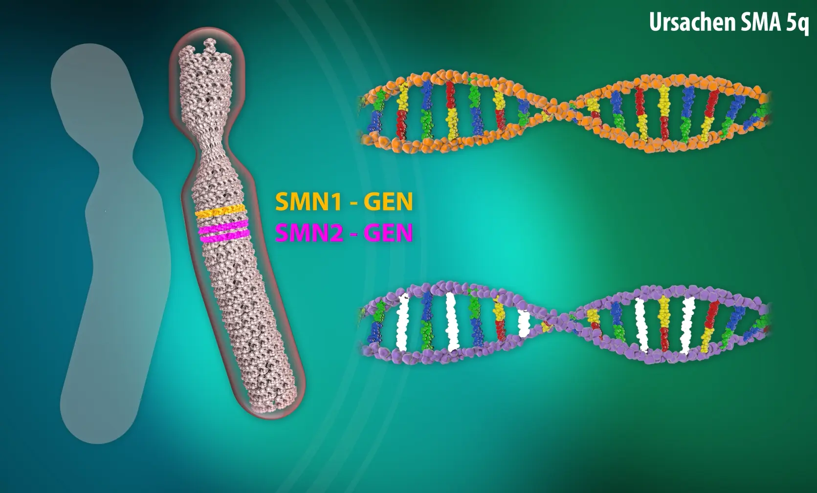 muskelatrophie ursachen - Wie kommt es zu einer Atrophie