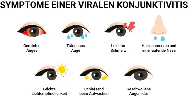 bindehautentzündung schwangerschaft hausmittel - Wie kriegt man eine Bindehautentzündung möglichst schnell wieder weg