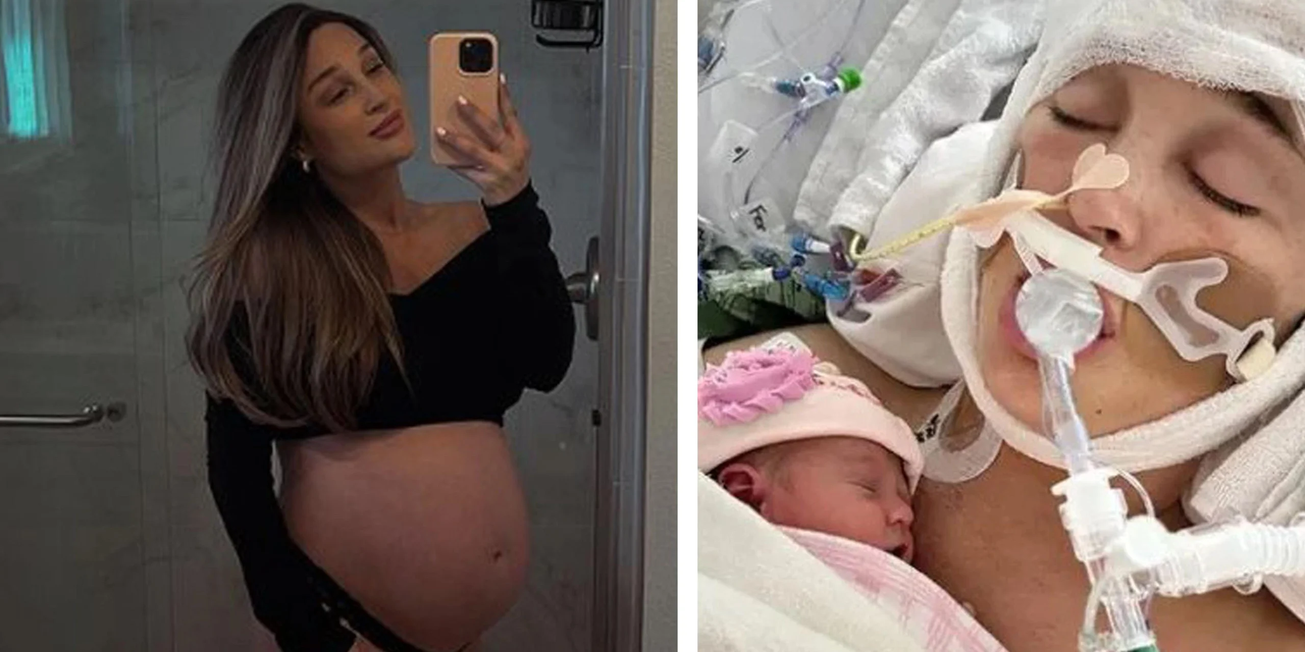 aneurysma geburt - Wie kündigt sich ein Aneurysma an