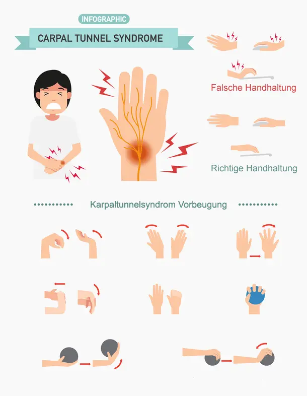 karpaltunnelsyndrom nach geburt schlimmer - Wie lange besteht ein Karpaltunnelsyndrom nach der Geburt