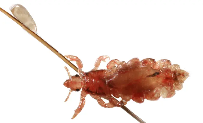 läuse wie lange zu hause - Wie lange darf man bei läusebefall nicht in die Schule