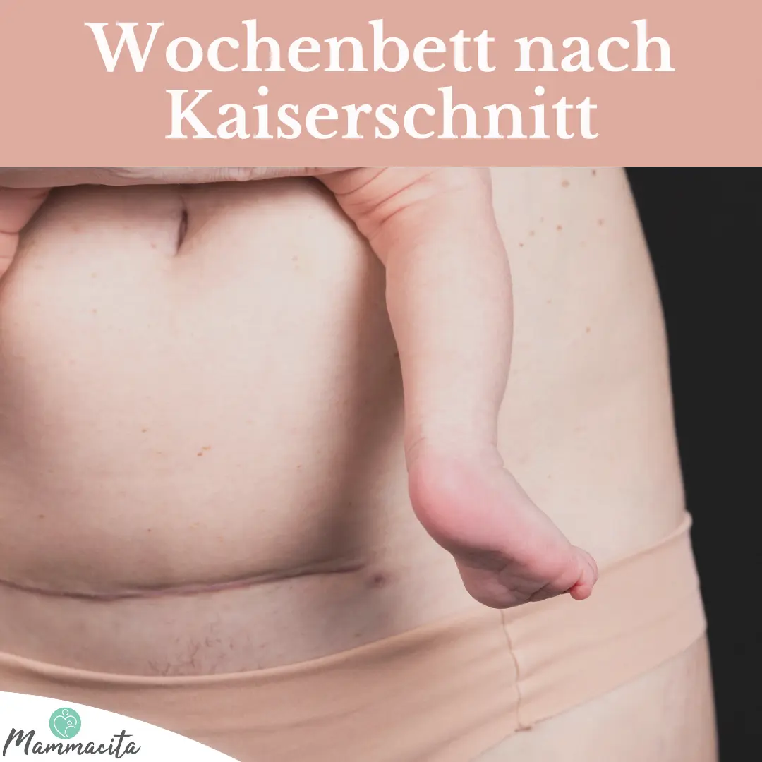 blähungen nach kaiserschnitt - Wie lange Darmprobleme nach Kaiserschnitt
