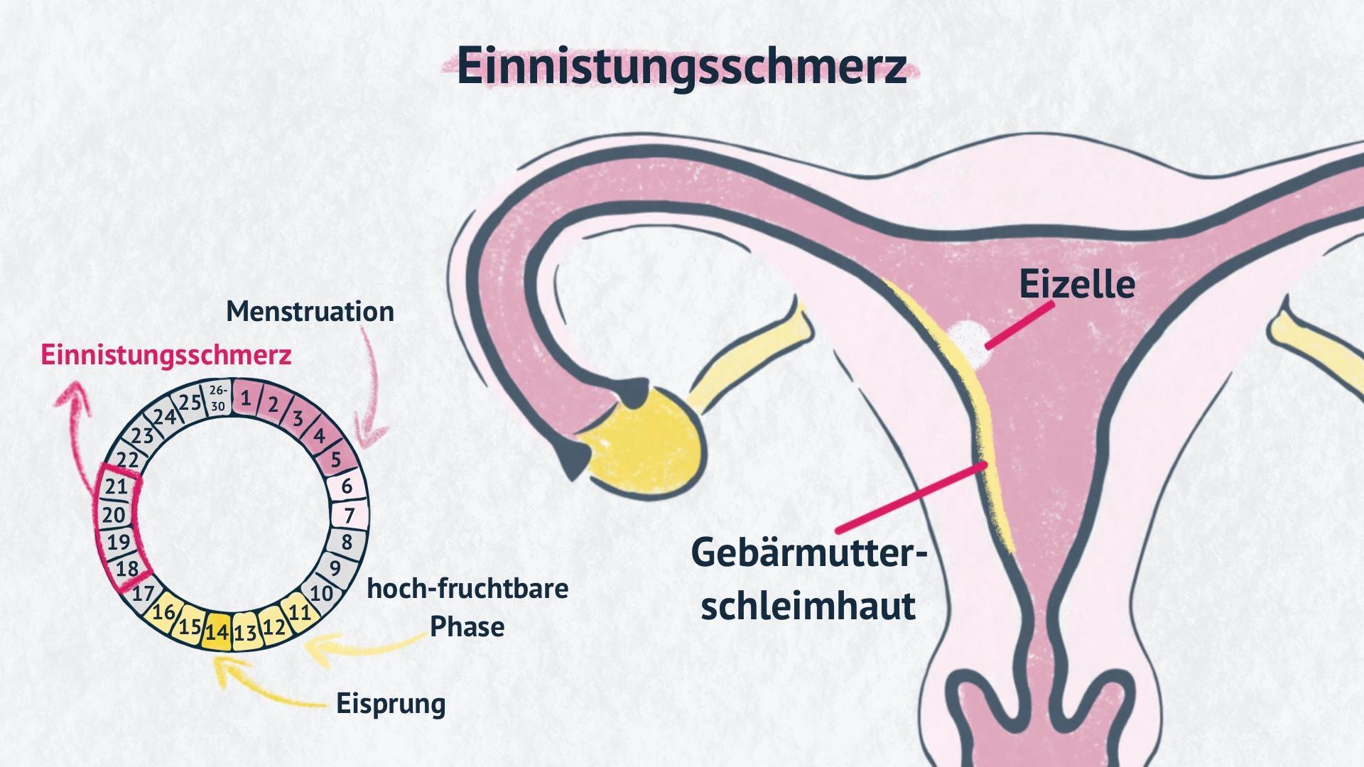 andauernde unterleibsschmerzen schwangerschaft - Wie lange dauert das Ziehen im Unterleib in der Schwangerschaft