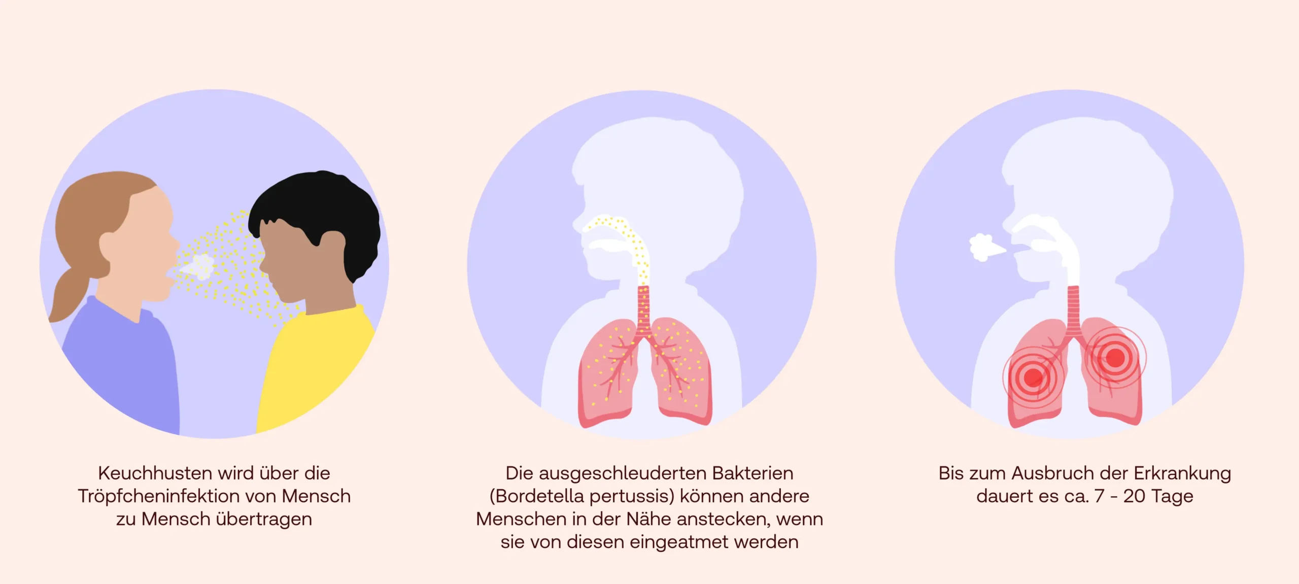 diagnose keuchhusten - Wie lange dauert ein Keuchhusten Test