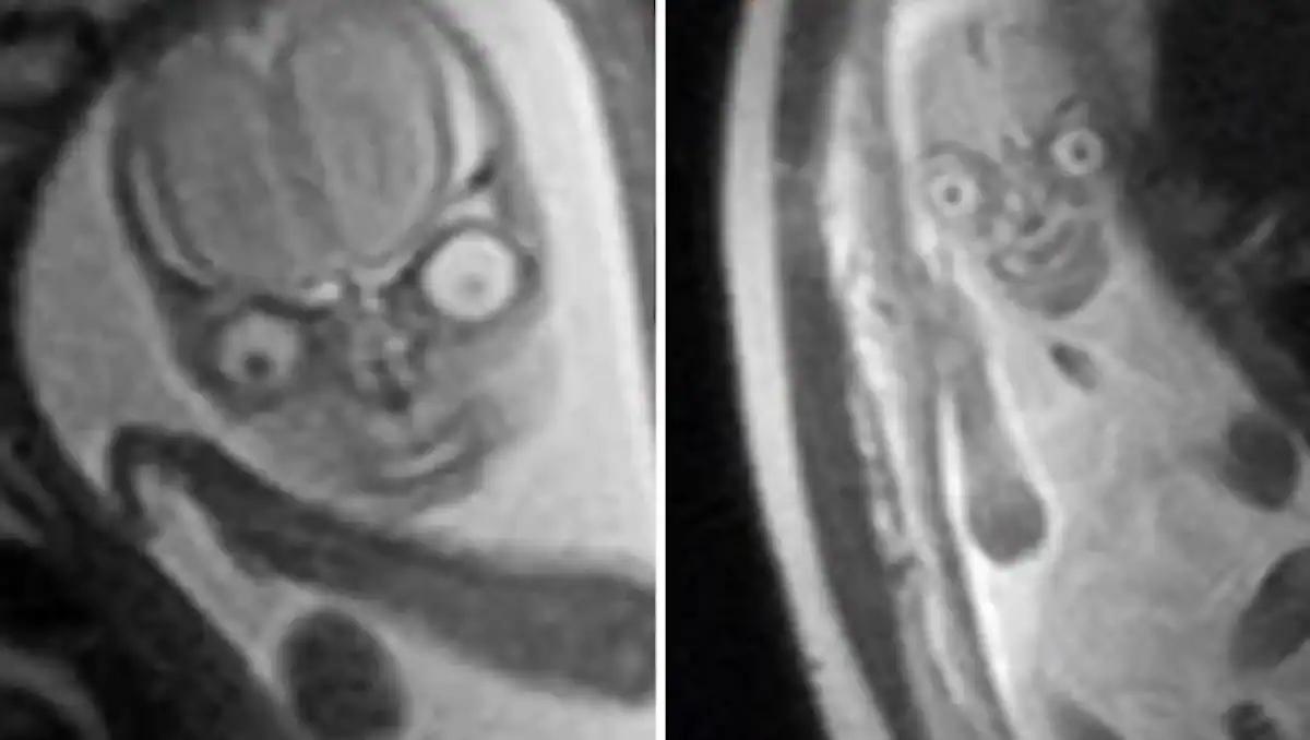 mrt schwangerschaft erfahrungen - Wie lange dauert ein MRT mit Kontrastmittel