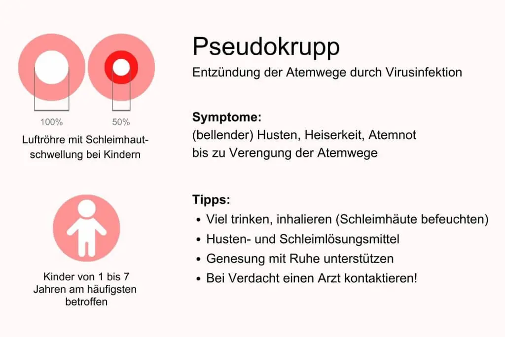 krupphusten symptome - Wie lange dauert ein Pseudokrupp Husten