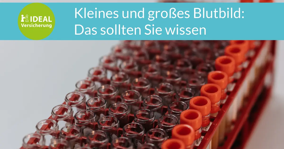 bluttest schwangerschaft wie schnell ergebnis - Wie lange dauert eine Blutuntersuchung beim Frauenarzt