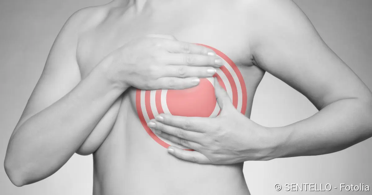 Brustschmerzen nach der Geburt: Ursachen, Symptome und Behandlung - Wie lange dauert es bis ein Milchstau weg ist brustschmerzen nach geburt - Wie lange dauert es bis ein Milchstau weg ist