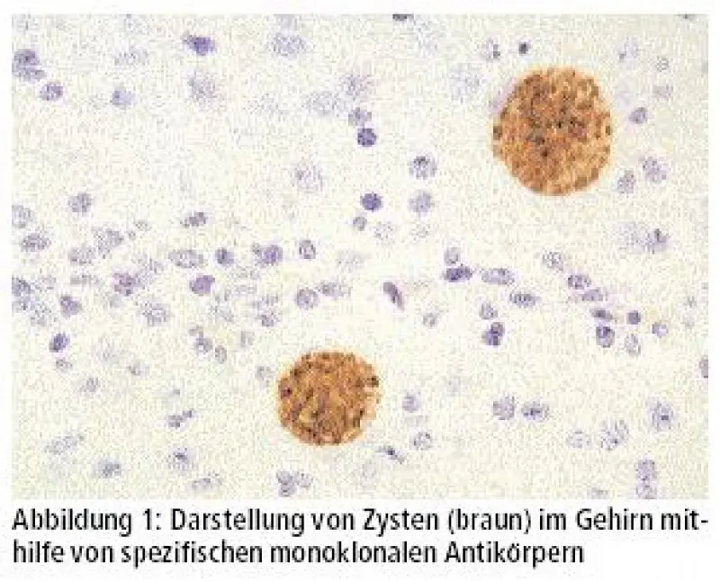immunität toxoplasmose - Wie lange hat man Toxoplasmose Antikörper