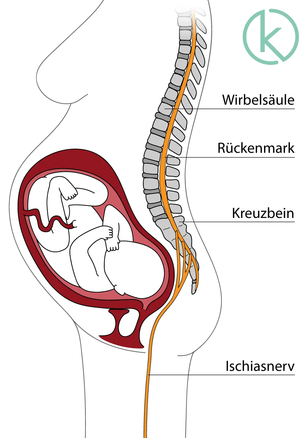 ischias nach geburt - Wie lange Ischiasschmerzen nach Geburt