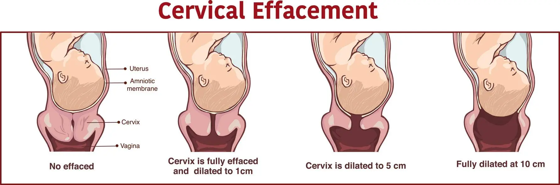 tagelang wehen vor geburt - Wie lange kann man Eröffnungswehen haben