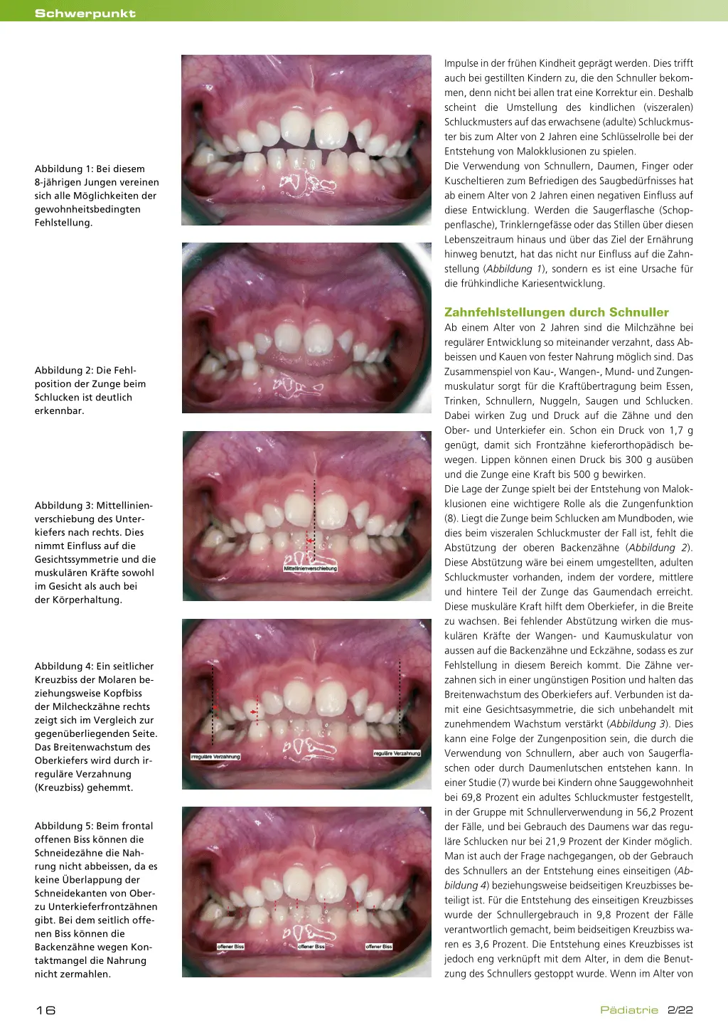 schnuller wie lange verwenden - Wie lange kann man Schnuller verwenden