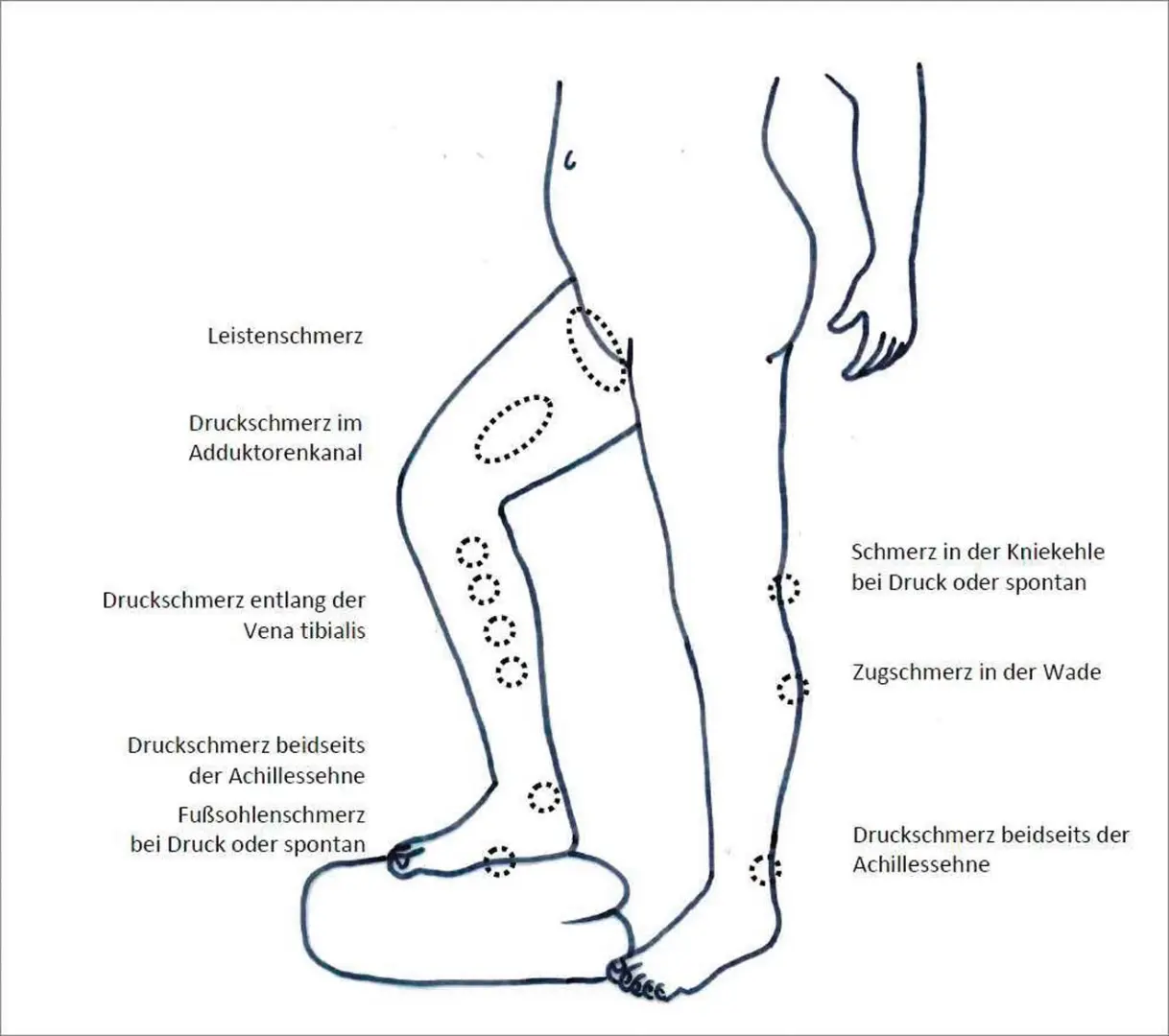 thrombose nach geburt erfahrungen - Wie lange Thrombosespritzen nach Geburt