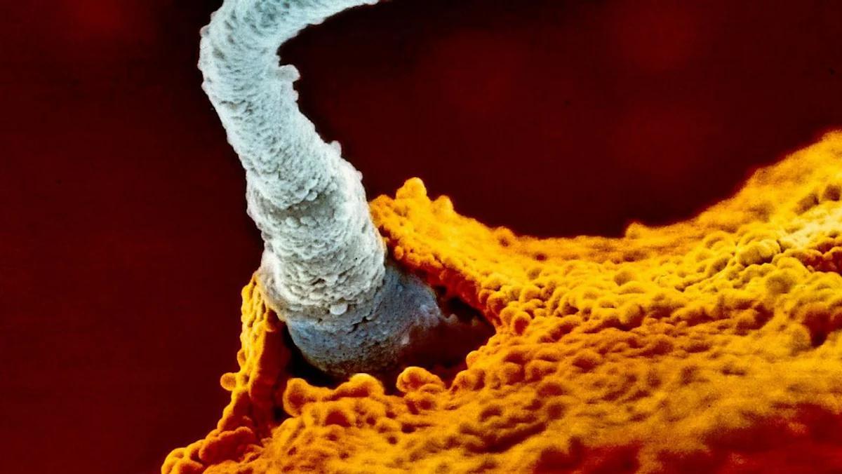 von der befruchtung bis zur geburt - Wie lange von Zeugung bis Befruchtung