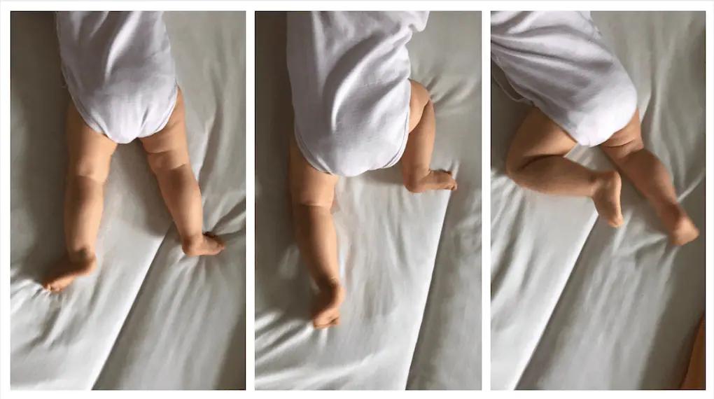 hüftdysplasie baby anzeichen - Wie macht sich eine Hüftdysplasie bemerkbar