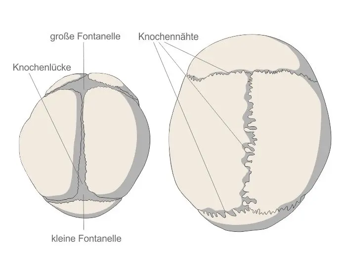 fontanelle bei geburt geschlossen - Wie merkt man das mit der Fontanelle was nicht stimmt