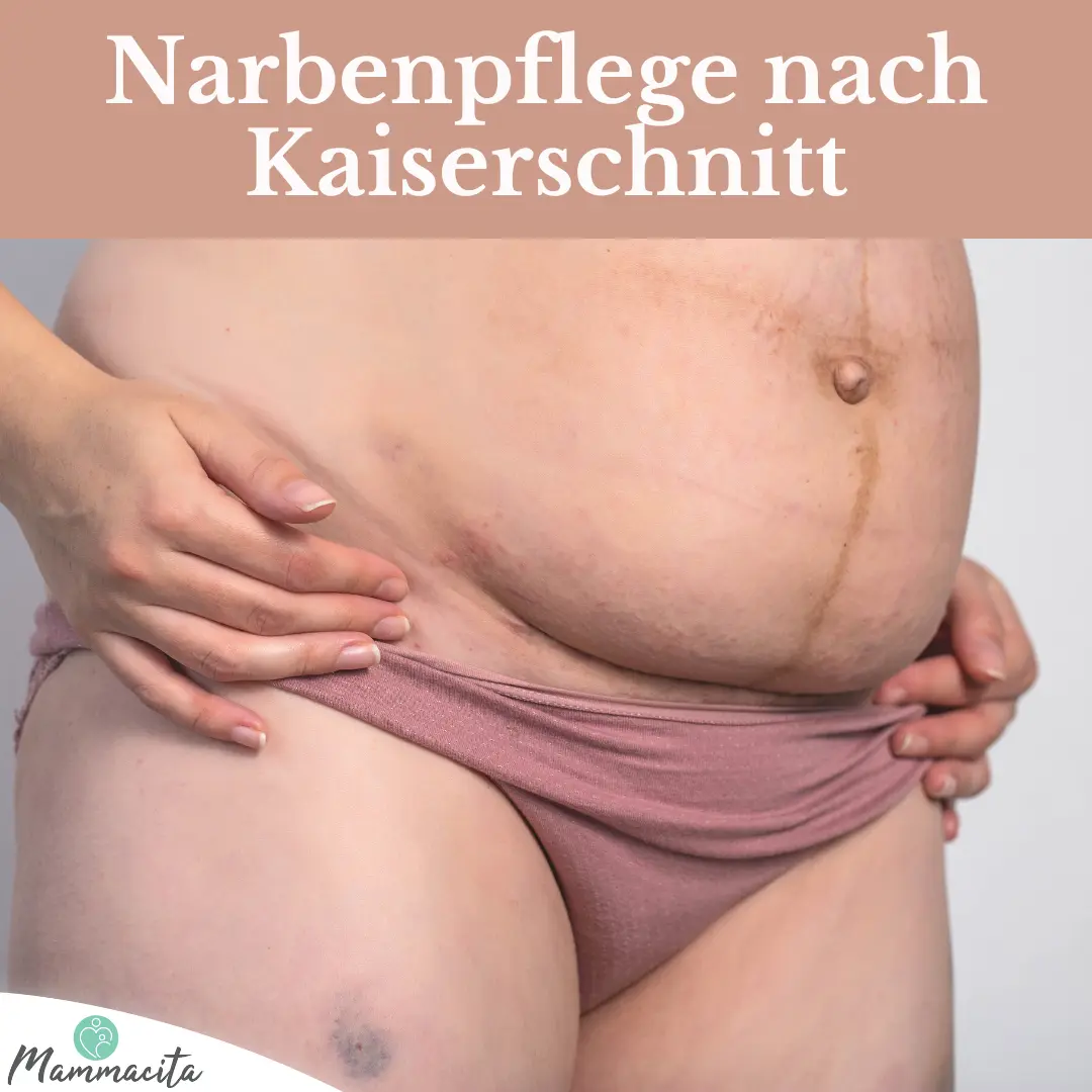 kaiserschnitt innere naht aufgegangen symptome - Wie merkt man dass Kaiserschnittnarbe gerissen ist