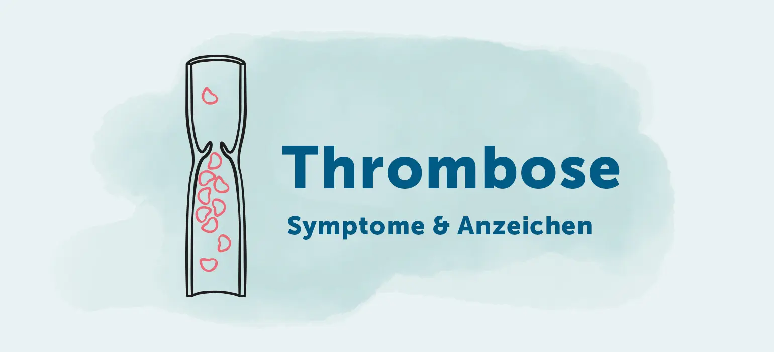 thrombosen schwangerschaft - Wie merkt man dass man eine Thrombose hat