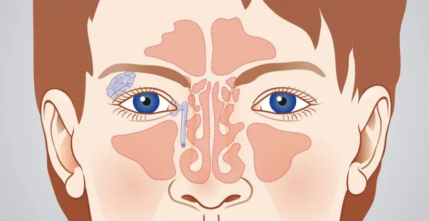 verbindung nase auge - Wie nennt man den Bereich zwischen Auge und Nase