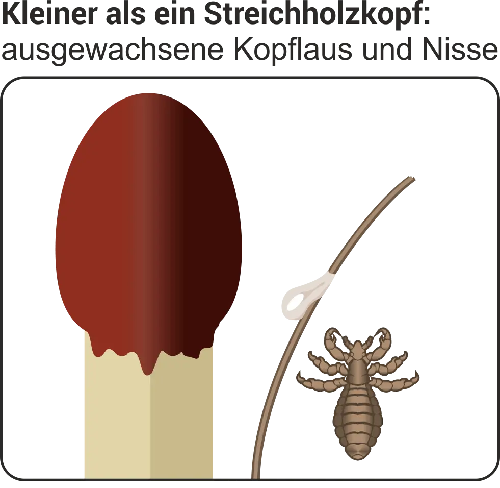 läuse in der schwangerschaft hausmittel - Wie oft Haare auskämmen bei Läusen