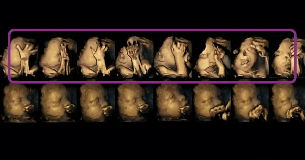 nikotin schwangerschaft - Wie schädlich sind 2 Zigaretten am Tag in der Schwangerschaft