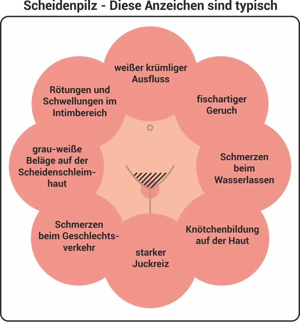 scheidenpilz schwangerschaft wie schnell zum arzt - Wie schnell mit Scheidenpilz zum Arzt