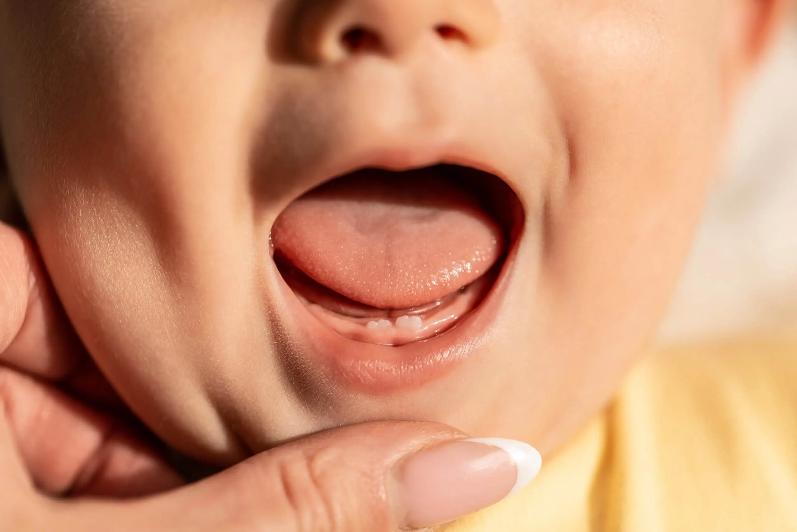 babys zahnen symptome - Wie sieht beginnendes Zahnen aus