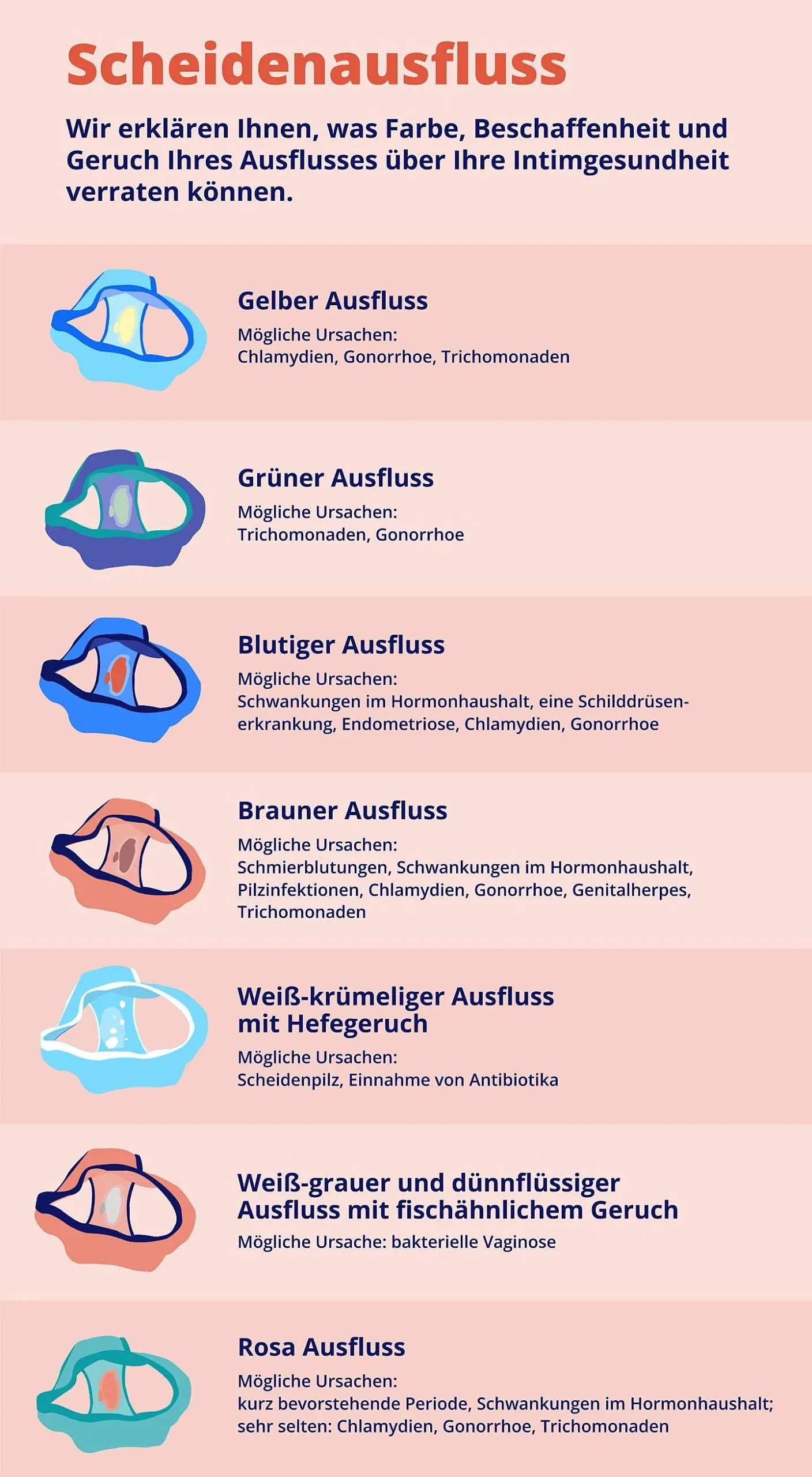 grüner ausfluss schwangerschaft - Wie sieht der Ausfluss in der 4 SSW aus