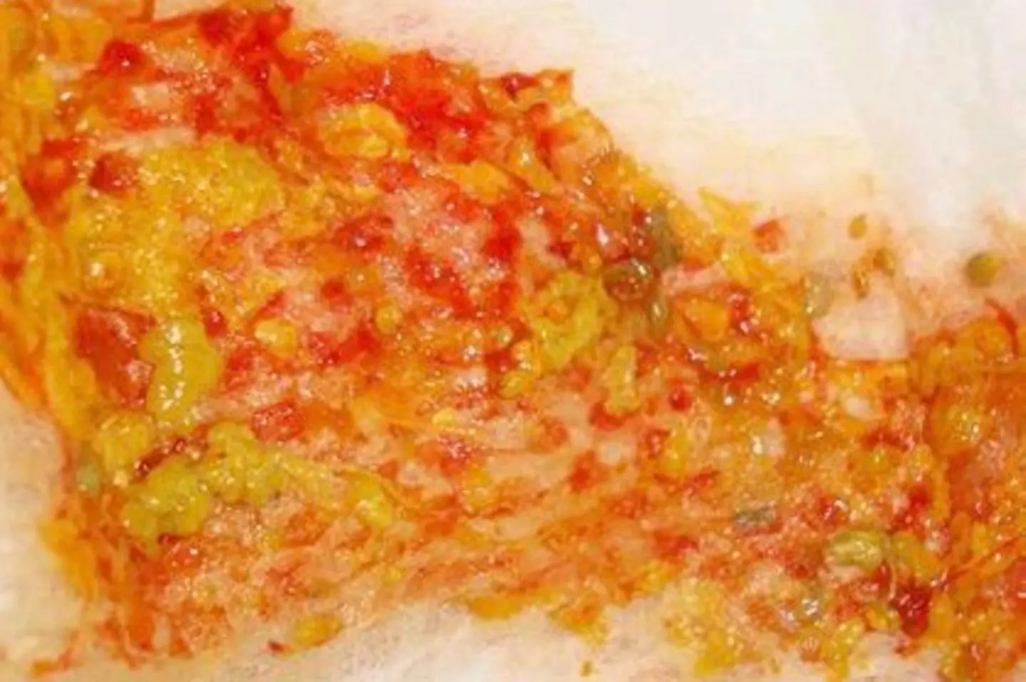 rote stückchen im stuhl - Wie sieht geronnenes Blut im Stuhl aus