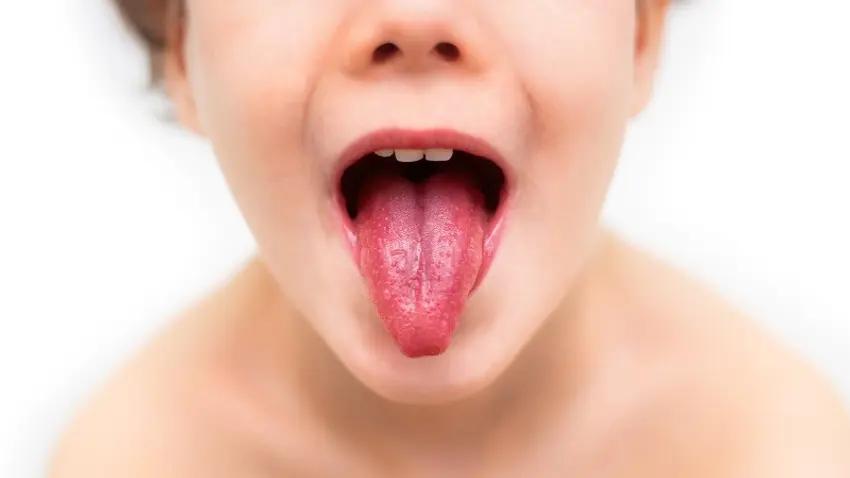 fieber und ausschlag kind - Wie sieht Scharlach Ausschlag bei Kindern aus