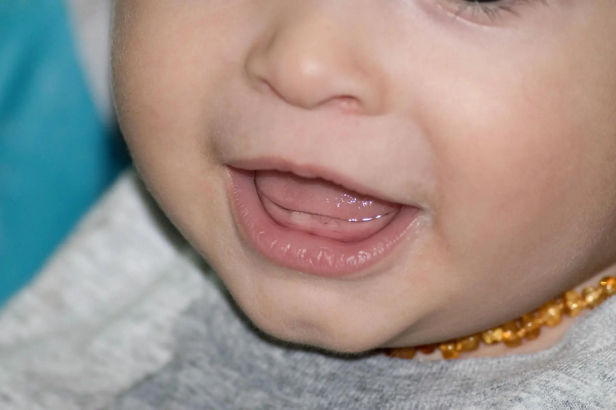 wie sieht es aus wenn zähne kommen - Wie sieht Zahnfleisch aus wenn Zahn kommt Baby