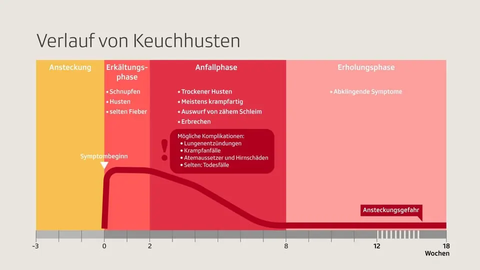 Keuchhusten: Symptome, Diagnose und Behandlung - Wie stellt der Arzt fest dass man Keuchhusten hat keuchhusten fieber - Wie stellt der Arzt fest dass man Keuchhusten hat