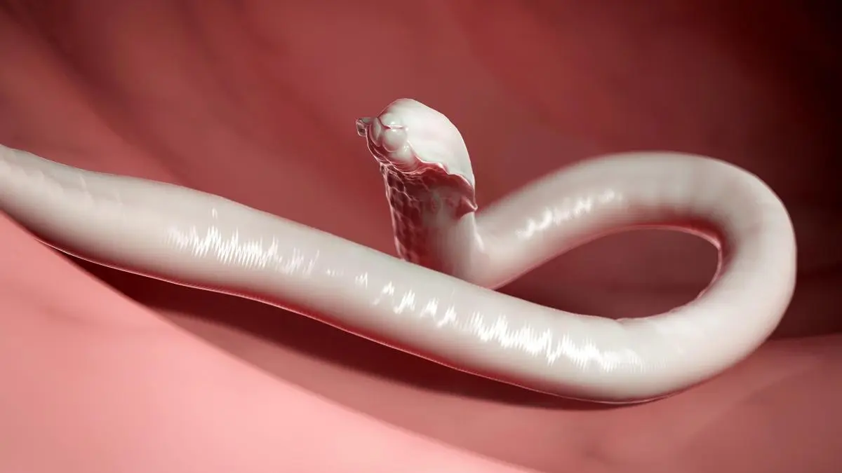 würmer in der schwangerschaft - Wie stellt man fest ob man Würmer hat