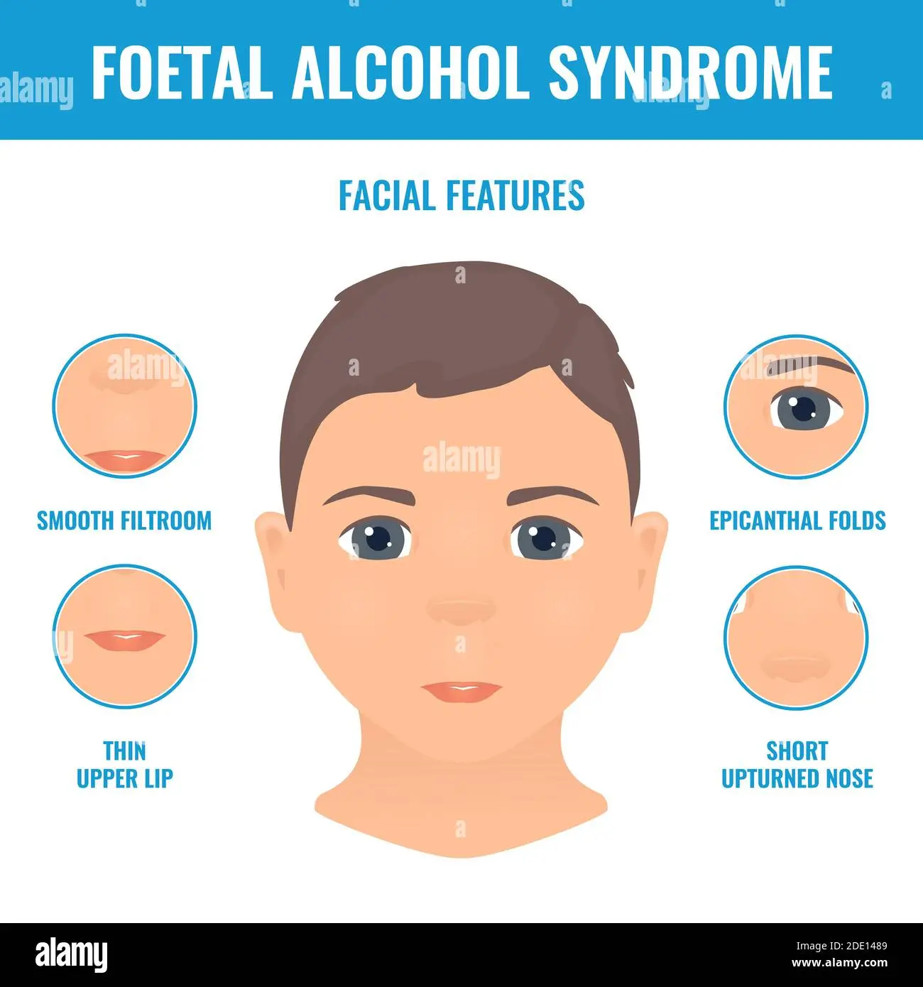 typisch fas gesicht - Wie verhalten sich Erwachsene mit FAS