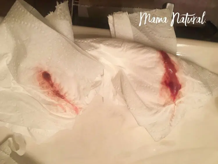 frisches blut schwangerschaft - Wie viel Blut ist in der Frühschwangerschaft normal