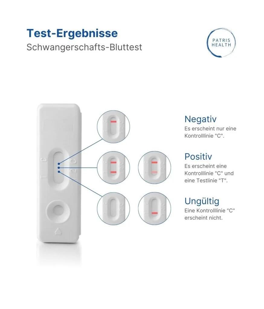 Bluttest hCG Schwangerschaft: Kosten und Informationen - Wie viel kostet ein hCG Bluttest bluttest hcg schwangerschaft kosten - Wie viel kostet ein hCG Bluttest