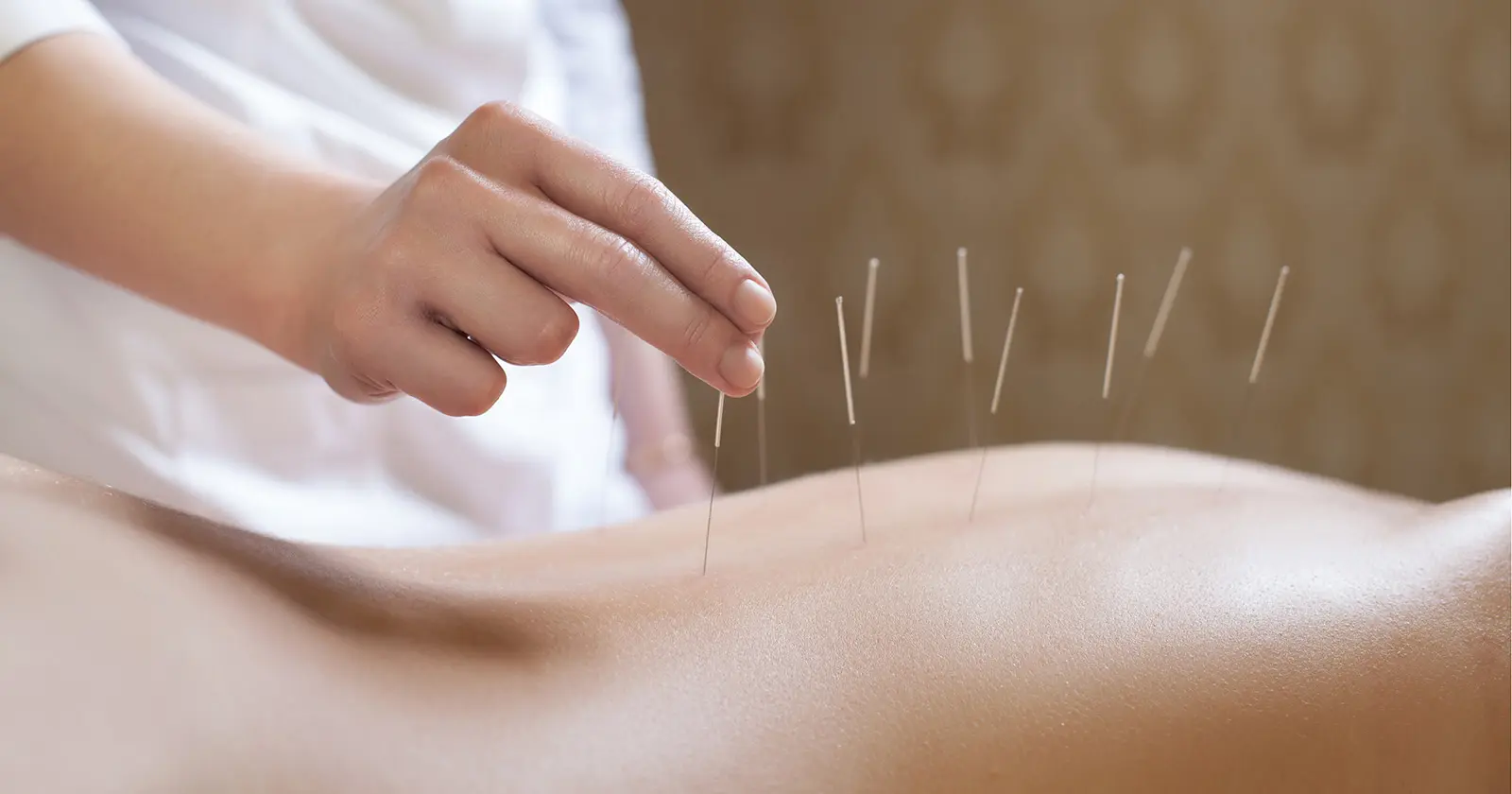 akupunktur für geburt - Wie viel kostet geburtsvorbereitende Akupunktur