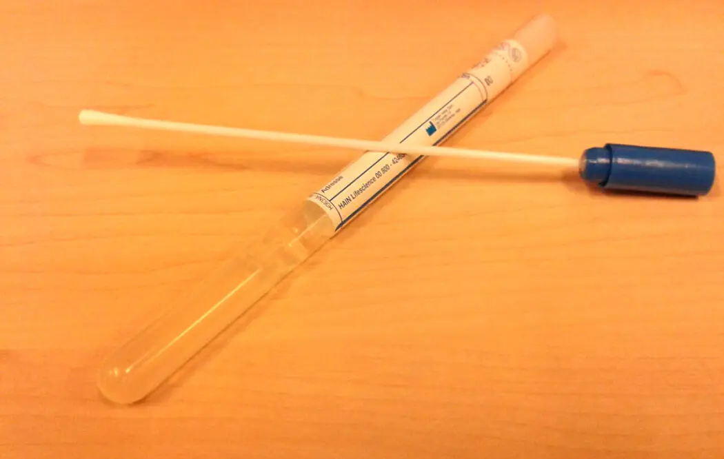 streptokokken test schwangerschaft - Wie viel kostet Streptokokken Abstrich Schwangerschaft