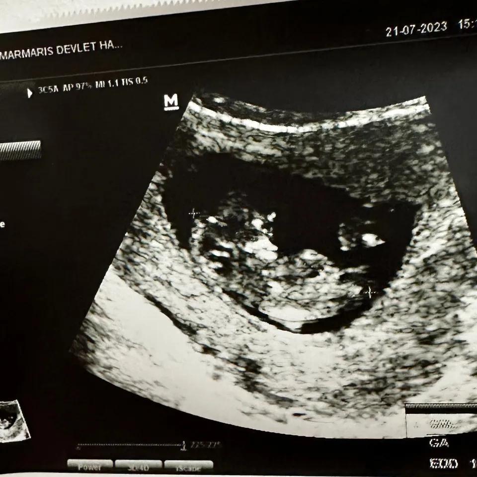 visum familienzusammenführung schwangerschaft - Wie viel muss man verdienen für Familienzusammenführung mit Kind